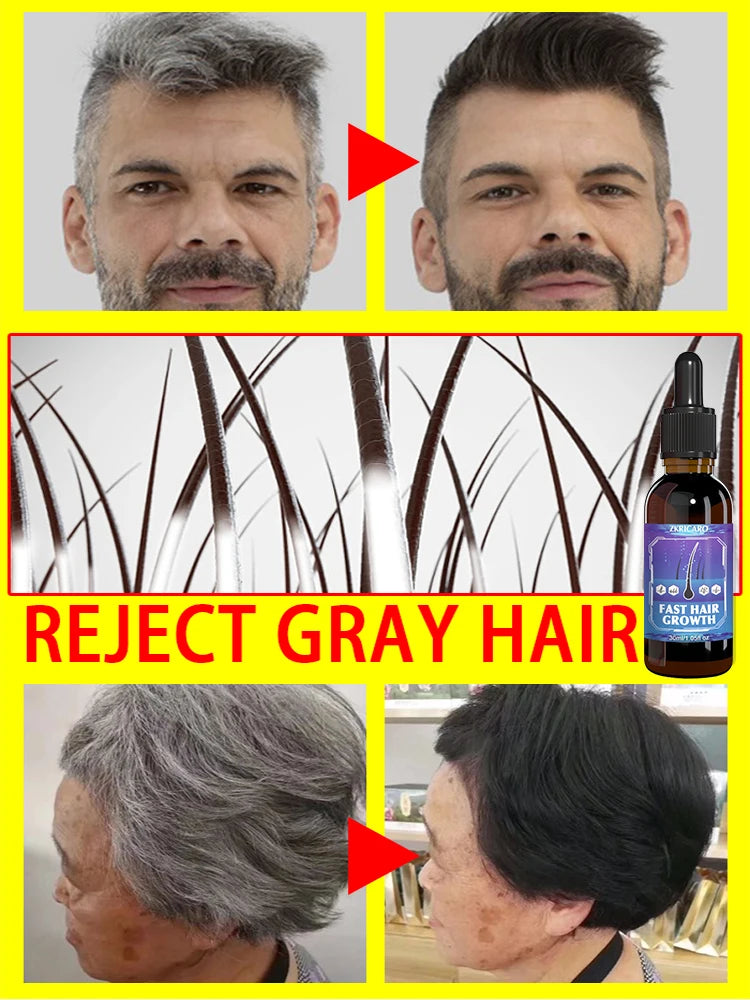 Turn white hair into black hair, remove gray hair in 7 days and restore natural and healthy hair color