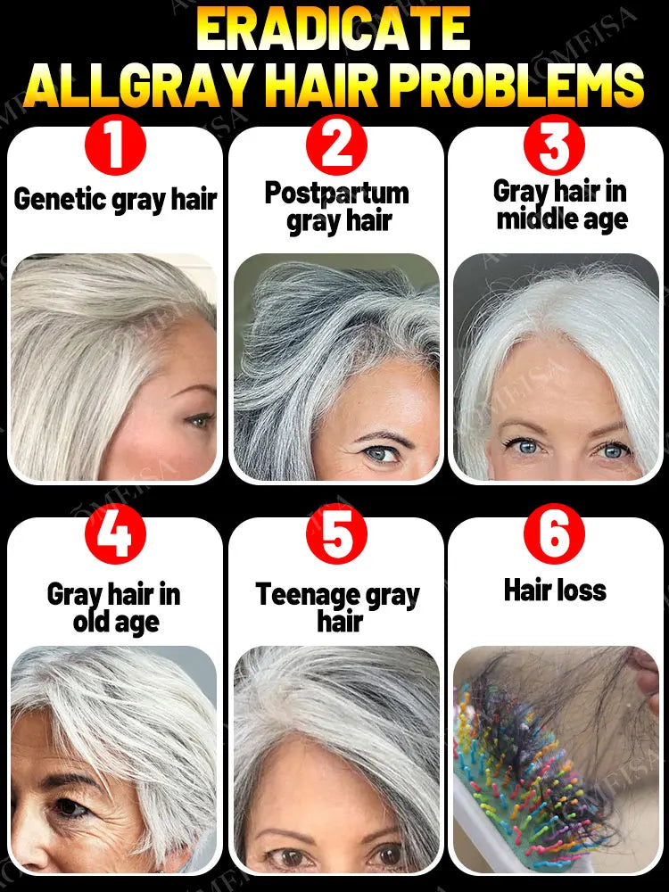 Turn white hair into black hair, remove gray hair in 7 days and restore natural and healthy hair color