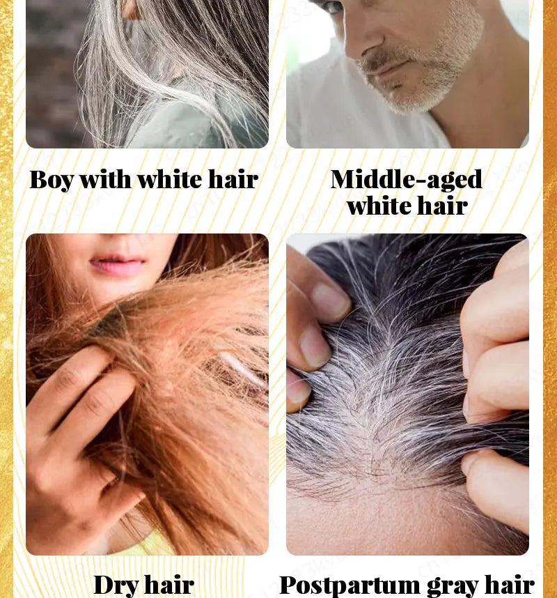 Turn white hair into black hair, remove gray hair in 7 days and restore natural and healthy hair color