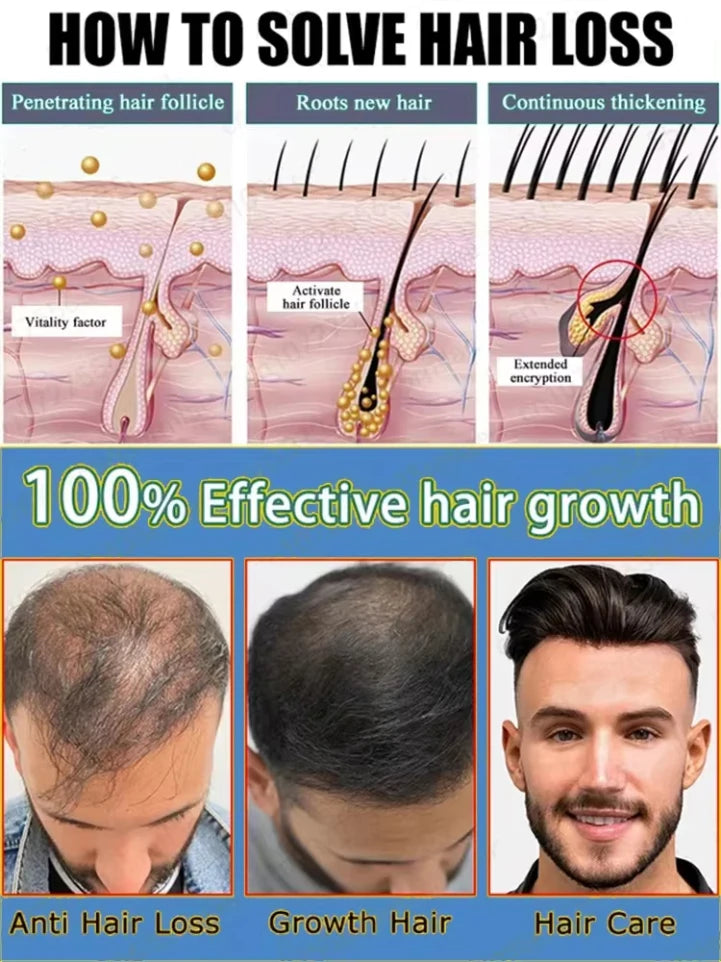 Hot selling product, 99% of buyers buy again, have more and more hair, say goodbye to baldness, thick hair